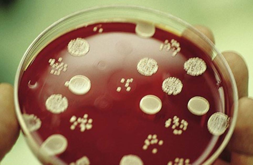 Agar dilution method