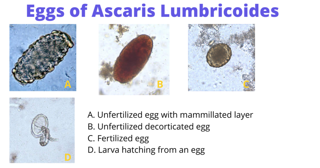 - Various types of eggs ofAscaris lumbricoides(Source: CDC)