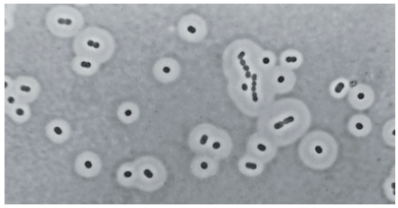 Capsules of Acinetobacter species as seen under phase-contrast microscopy after negative staining  - Capsules ofAcinetobacterspecies as seen under phase-contrast microscopy after negative staining (Image source: Elliot Juni)