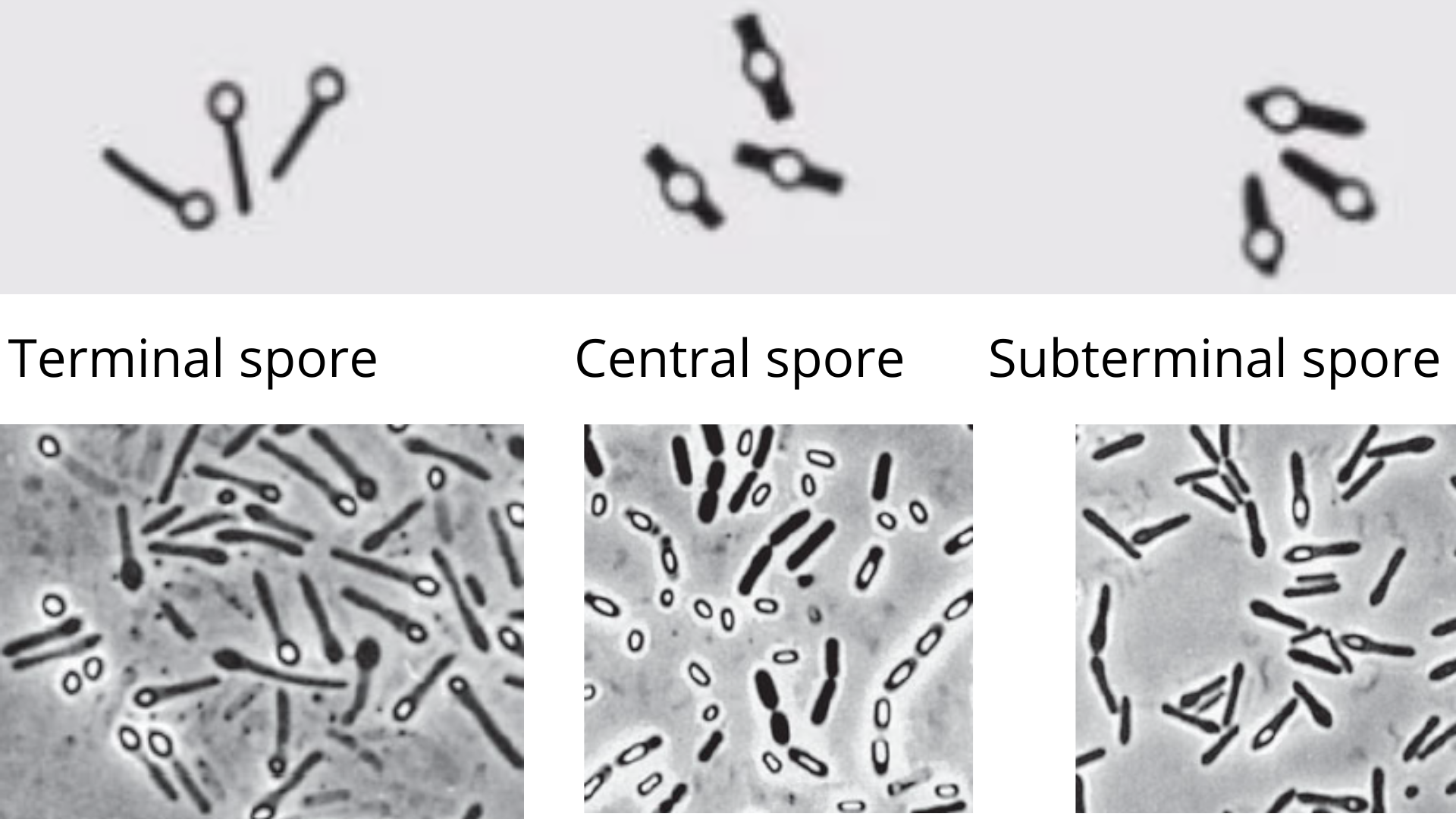 Bacterial spores