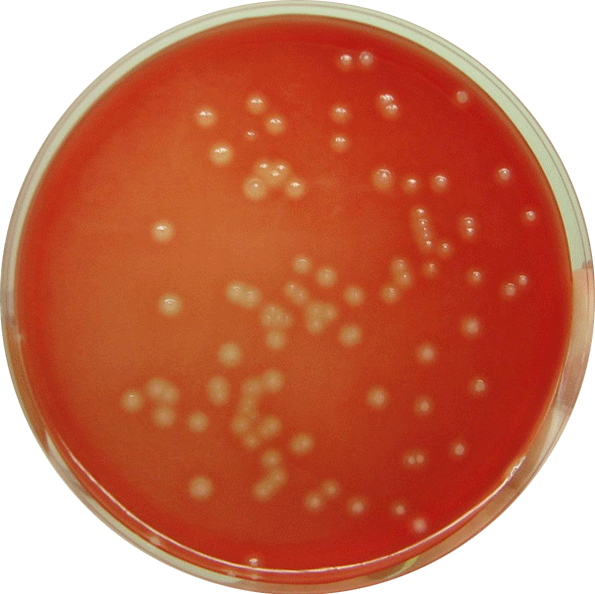 Beta-hemolytic colonies of Streptococcus agalactiae - Beta-hemolytic colonies ofS. agalactiae(Image source: wikimedia.org)