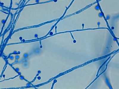 - Slightly pyriform (tear-drop) shaped conidia  ofB. dermatitidis(Image source:http://thunderhouse4-yuri.blogspot.com/)