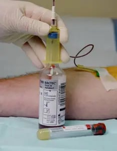 - Collection of Blood for Culture