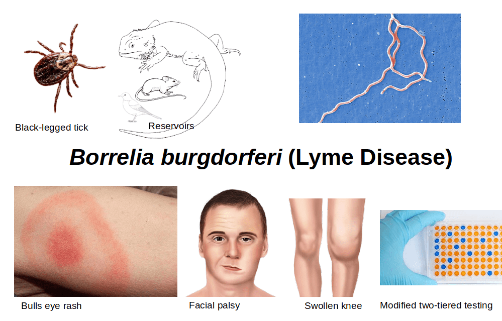 Borrelia Burgdorferi Lyme Disease min