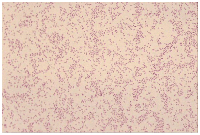 Brucella appearing as faintly staining ram-negative coccobacilli  - Brucellaappearing as faintly staining ram-negative coccobacilli