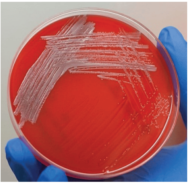 Brucella colonies in blood agar - Brucellacolonies in blood agar