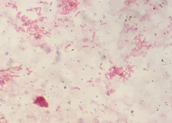 - B. pseudomalleiin Gram-stain (image source-Ian Martin, idmic-net).