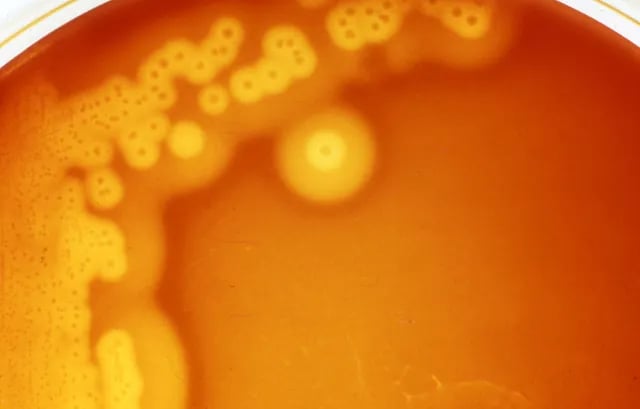 Target hemolysis (Double zone hemolysis) - Target hemolysis (Double zone hemolysis)Image source: UPEI University