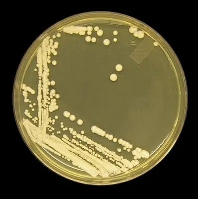 - Candida albicanson Sabouraud-Dextrose Agar at 48 hours at 30°C (Imagesource)