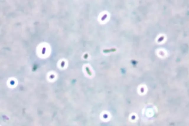 Capsule stain - Capsule staining by India ink method (at 1000x magnification)