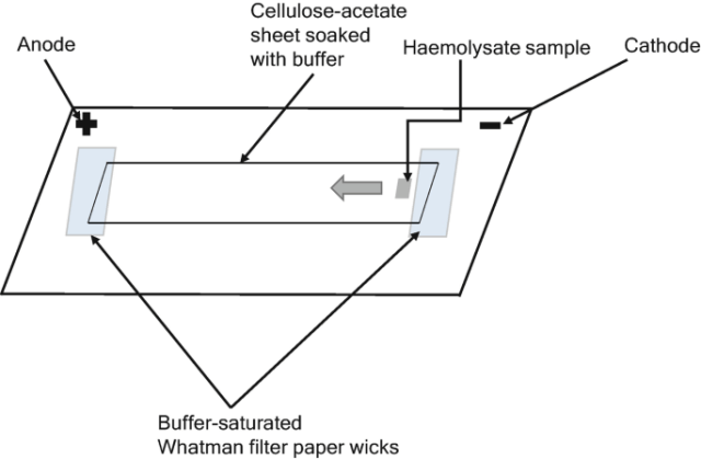 Cellulose acetate electrophoresis - Diagram of cellulose acetate electrophoresis