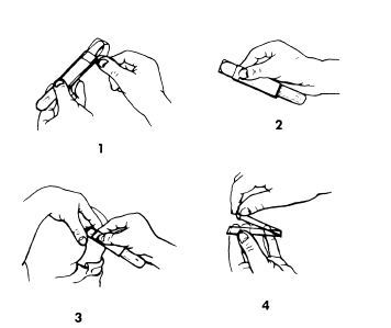 Cellulose tape preparation - Collection of E.vermicularis eggs by the cellulose tape method (Source:Gracia L.S. 2001.Diagnostic Medical Parasitology)