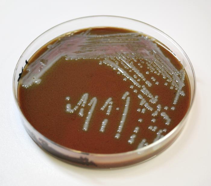 - F. tularensisin cysteine enriched chocolate agar