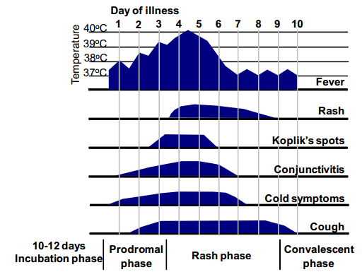 Clinical Feature of Typical Measles - Fig: Clinical features of typical measles – time course from onset of illness