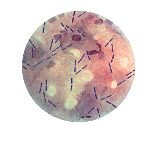 Boxcar shaped C. perfringens - Boxcar shapedC. perfringens