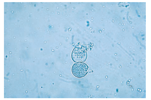 - KOH mount showing two spherules ofCoccidioidesspp. filled with endospores.