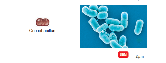 - Cocobacillus (Image source: Ref-3)