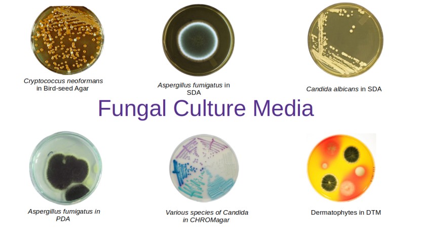 - Common fungal culture media