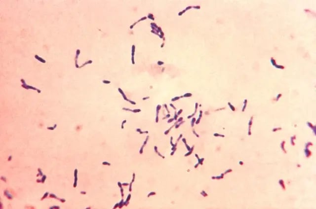 Club shaped Corynebacterium diphtheriae in Methylene Blue Staining - Club shapedCorynebacterium diphtheriaein Methylene Blue StainingSource: Source: PHIL Photo ID# 7323