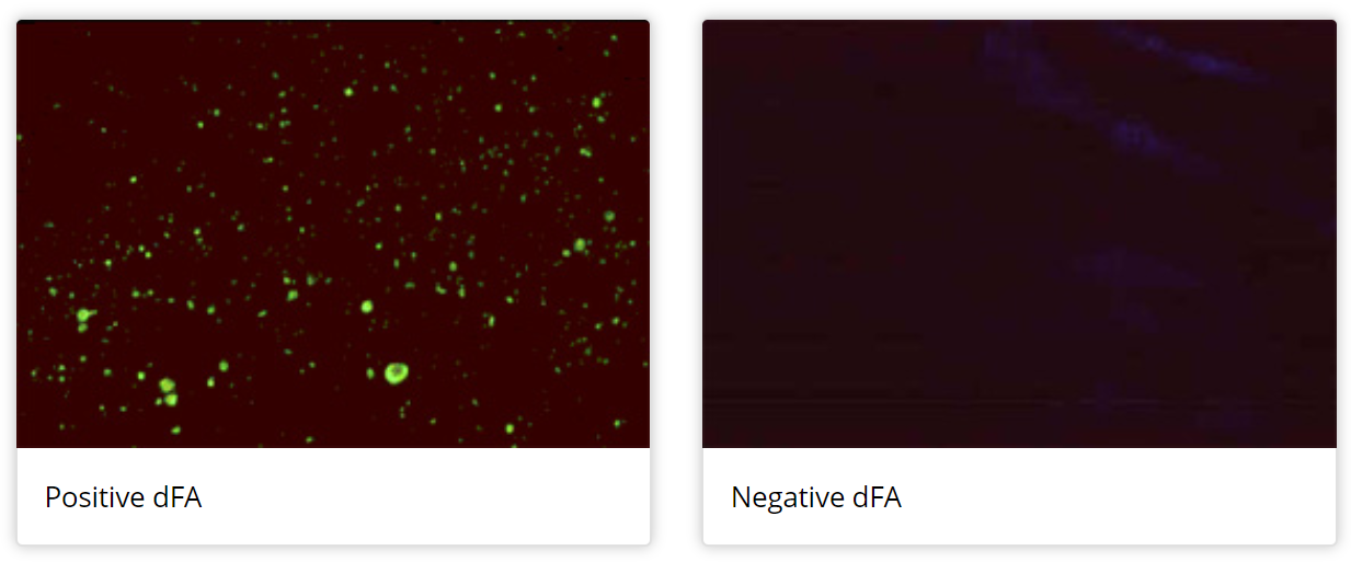 - Direct fluorescent antibody (DFA) test (Image source:CDC)