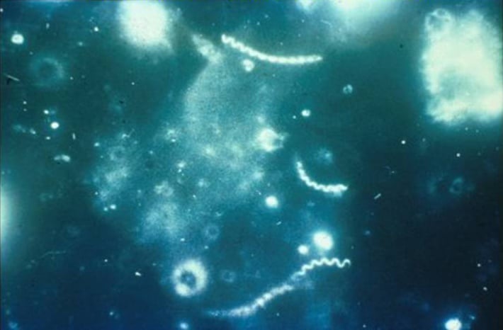 Darkfield micrograph of Treponema pallidum - Darkfield micrograph ofTreponema pallidum(source: CDC)