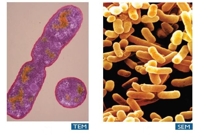 - Colorized electron micrographs of E.coli produced by TEM and SEM (Source: TEM-Dennis kunkel/phototake, TEM-David M.Phillips/Visuals Unlimited)