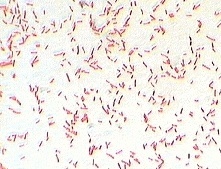 Gram Stain Reaction of E.Coli - Gram Stain Reaction ofE. coli