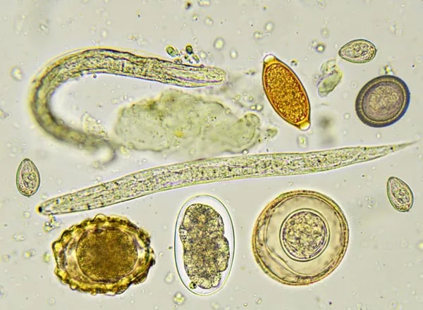 - Eggs (ova) of various intestinal parasites