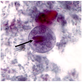 - Cyst ofEntamoeba histolytica