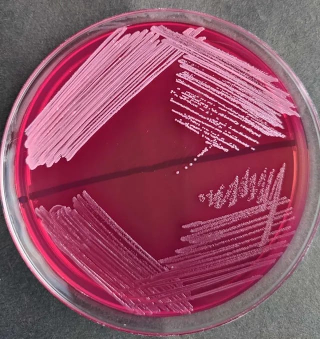 - Light pink, small colonies ofS. aureus(above) and dark pink-red, minute colonies ofEnterococcus(below) on MacConkey agar without bile salts and crystal violet.