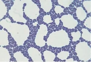 Staphylococcus in Gram Stain - Staphylococcus in Gram Stain