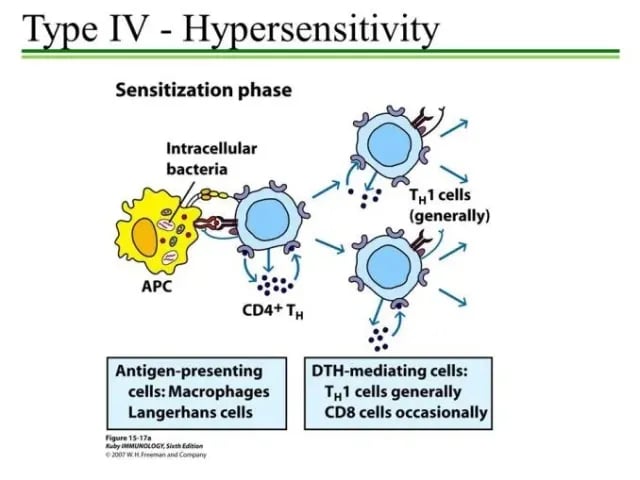 Type IV Hypersensitivity (Sensitization Phase) - Type IV Hypersensitivity (Sensitization Phase)