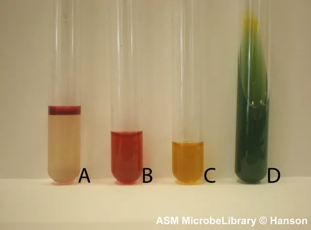 IMVic Test of E coli