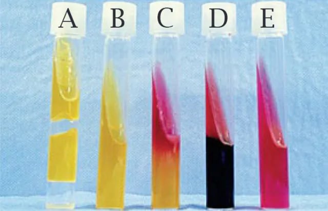 - Kligler’s iron agar (KIA) tubes with several reaction patternsA: Acid/Acid, Gas; B: Acid/Acid, No gas; C: Alkaline/Acid; D: Alkaline /Acid, H2S+; E: Alkaline/Alkaline