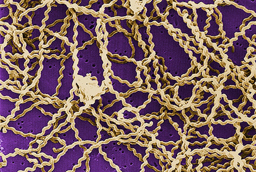 - 1998 Rob WeyantThis scanning electron micrograph (SEM) depicts a number ofLeptospira sp.bacteria atop a 0.1. µm polycarbonate filter.
