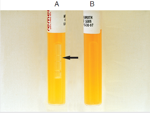 Lactobacillus MRS broth test - MRS broth testA: positive with gas; B: Positive but no gas. (Image source: Ref-1)