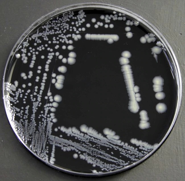 Buffered Charcoal Yeast Extract (BCYE) Agar - Legionellacolonies in BCYE Agar (Image source: ThermoFischer)