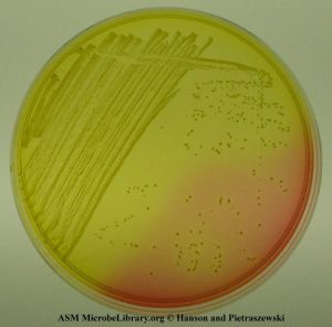 Yellow colonies of S. aureus in Mannitol Salt Agar (Photo by Anne Hanson and Matthew Pietraszewski, University of Maine - Yellow colonies ofS. aureusin Mannitol Salt Agar (Photo by Anne Hanson and Matthew Pietraszewski, University of Maine)