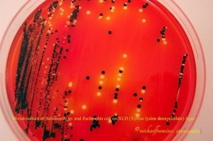 Fig: Mixed culture of E coli and Salmonella in XLD agar - Fig: Mixed culture ofE coliandSalmonellain XLD agar