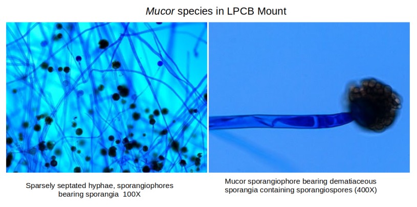 - Mucorspecies in LPCB mount (Imagesource)
