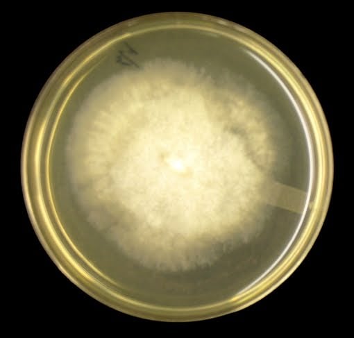 Mucor on SAB Agar plate 48hrs at 30°C - Mucor on SAB Agar plate 48hrs at 30°C (source)