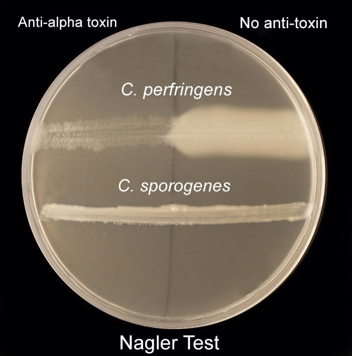 Naglers test