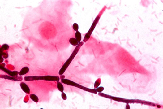 Pseudohyphae of Candida albicans - Pseudohyphae ofCandida albicans