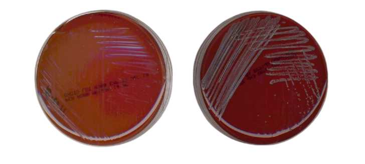 - PEA agar plates with 5% sheep blood incubated at 48 hours at 35°CLeft:Escherichia coli.Right:Staphylococcus aureusImage source: Cheeptham and Farday, ASM MicrobeLibrary