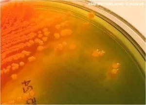 yellow-orange colonies of Proteus vulgaris in Hektoen Enteric Agar - Yellow-orange colonies ofProteus vulgarisin Hektoen Enteric Agar