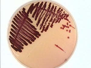 Red colored colonies of Serratia marcescens in MacConkey Agar (Source University of Maryland) - Red colored colonies ofSerratia marcescensin MacConkey Agar(Source University of Maryland)