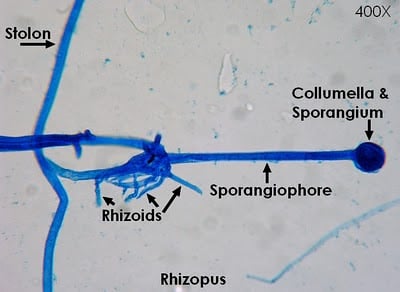 Labeled diagram of Rhizopus - An adhesive tape preparation ofRhizopusstained with LPCB mount (source)