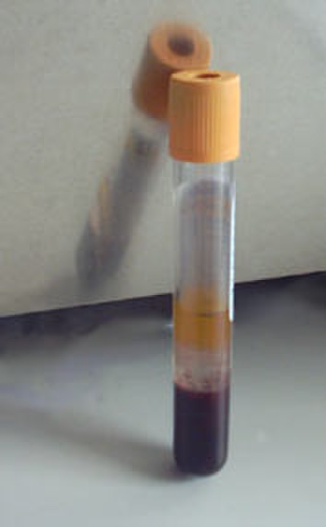 Gold sst tube - SST tube