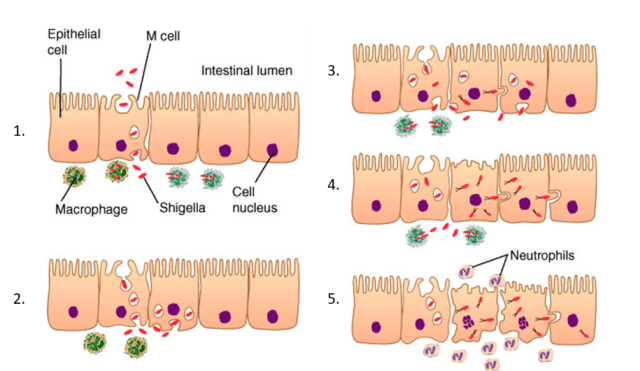 Shigella pathogenesis