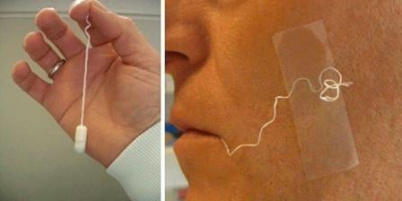 From left to right: Entero-Test device prior to swallowing, Entero-Test in situ - From left to right: Entero-Test device prior to swallowing, Entero-Test in situ (image source: Guiney WJ et al British Journal of Clinical Pharmacology)